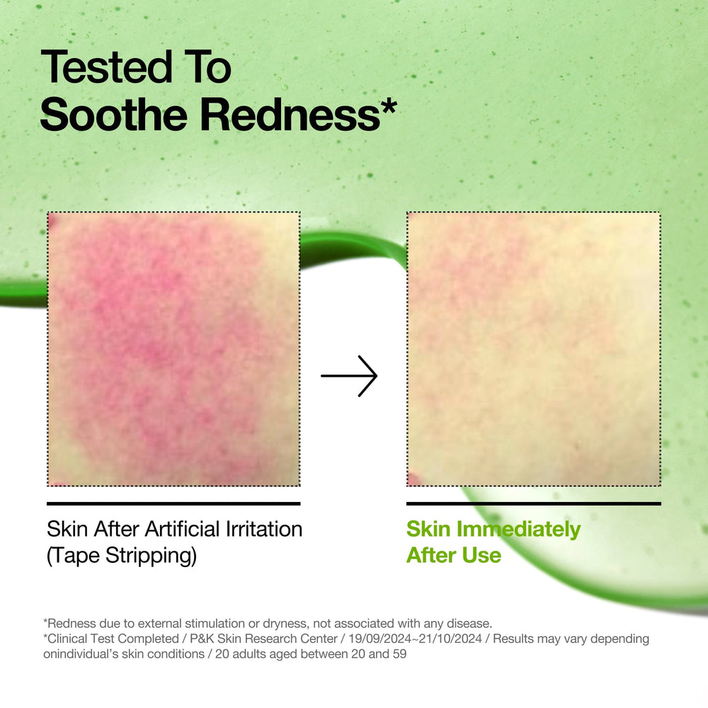 سرم تسکین‌دهنده‌ آزلیک اسید ۱۰٪ آنوا – کاهش قرمزی و لک پوست حساس - تصویر 3