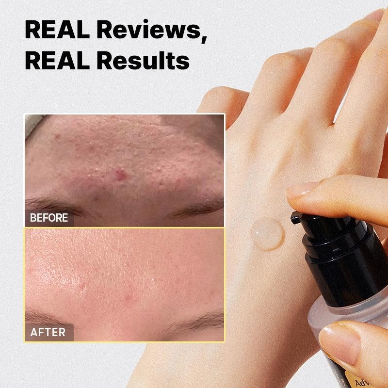 اسنس حلزون کوزارکس Advanced Snail 96 – ترمیم و آبرسانی عمیق - تصویر 5