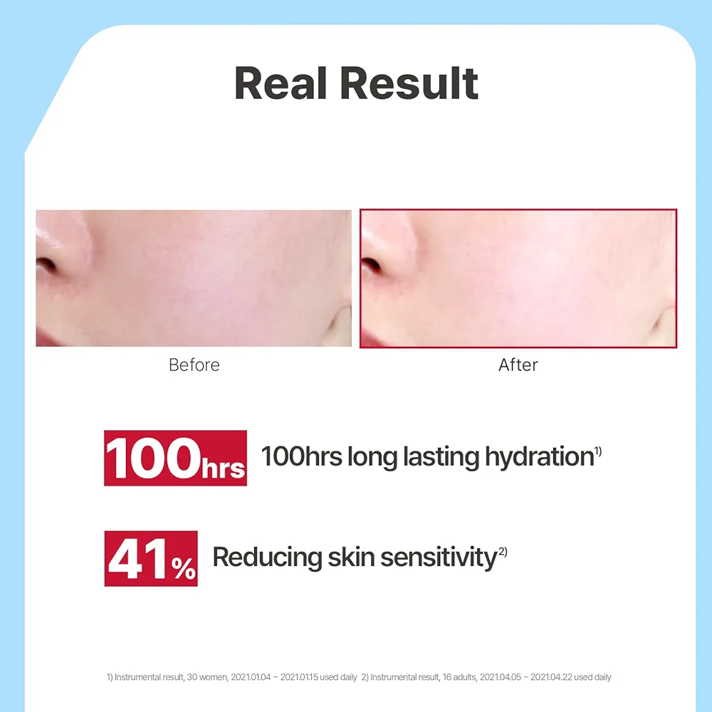 کرم سرامید اتو ایلیون ۲۰۰ میل - ترمیم سد دفاعی پوست خشک - تصویر 4